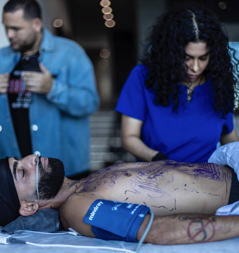 Dos días con 4 horas de anestesia cada una, fue el procedimiento al cuerpo del artista. (FOTO: lavanguardia.com)