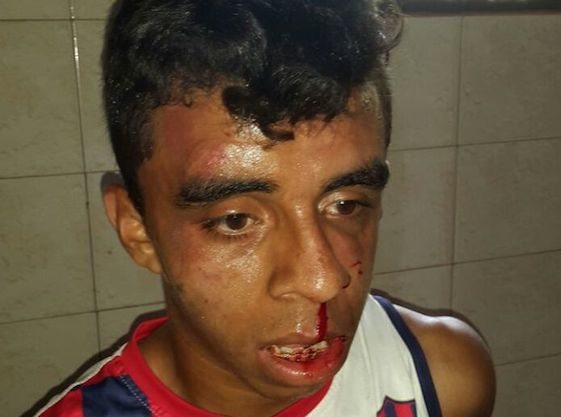 MOLIDO. Así quedó el detenido luego que los vecinos decidieron que debían hacer "justicia”.