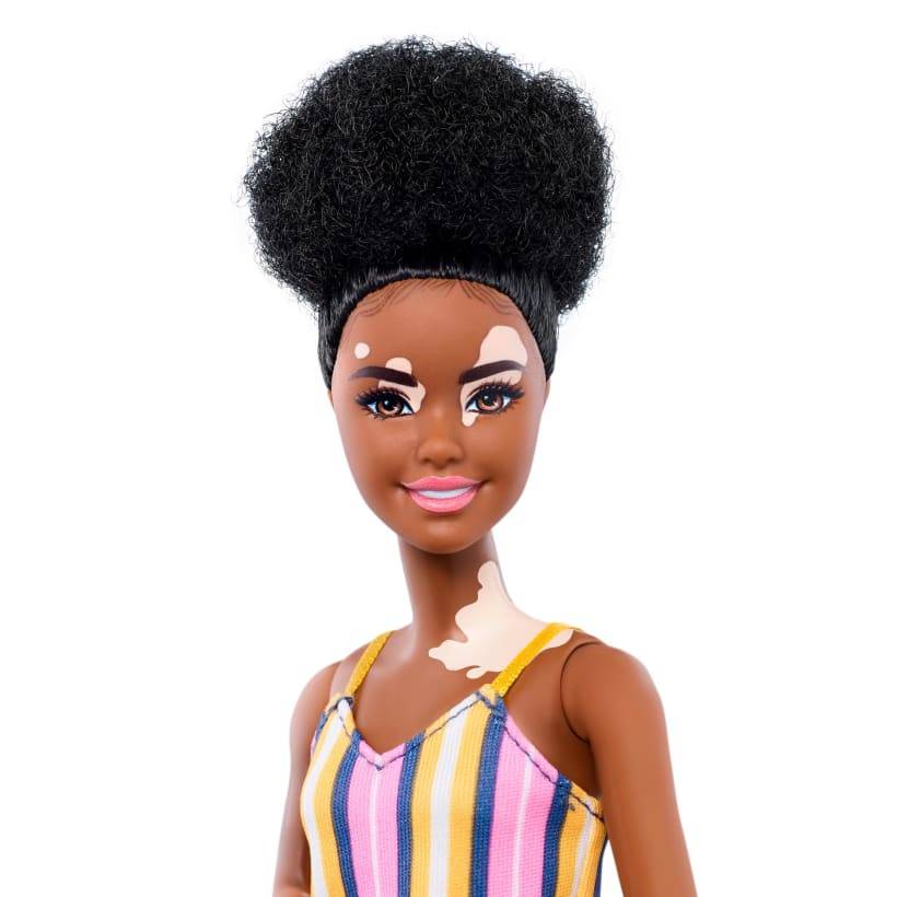 Barbie com síndrome de Down, cadeira de rodas e vitiligo: os