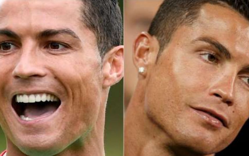 dientes de cristiano ronaldo