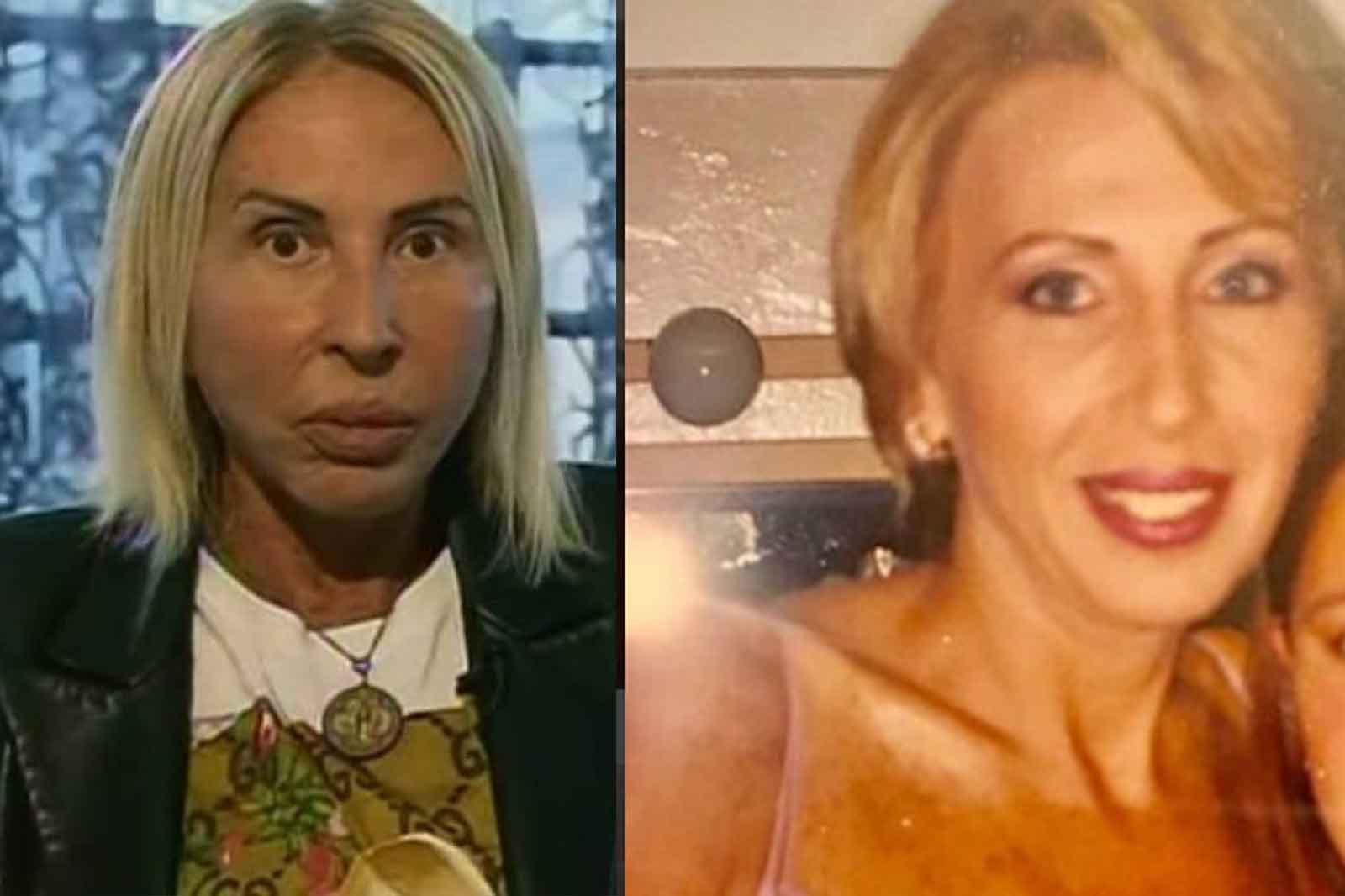 Qué se hizo Laura Bozzo? ¿Filtros o cirugía plástica?