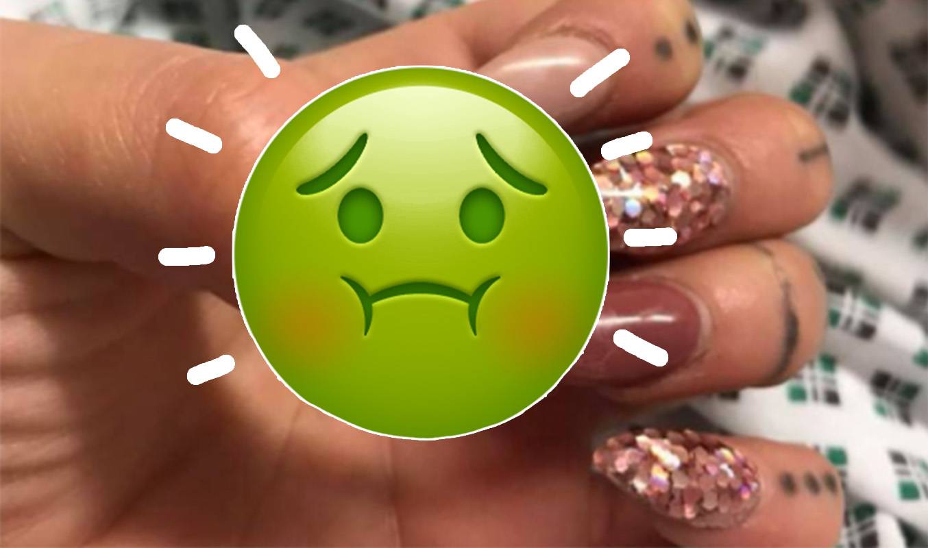 Viral. mujer casi pierde dedo luego de una infección por uñas postizas