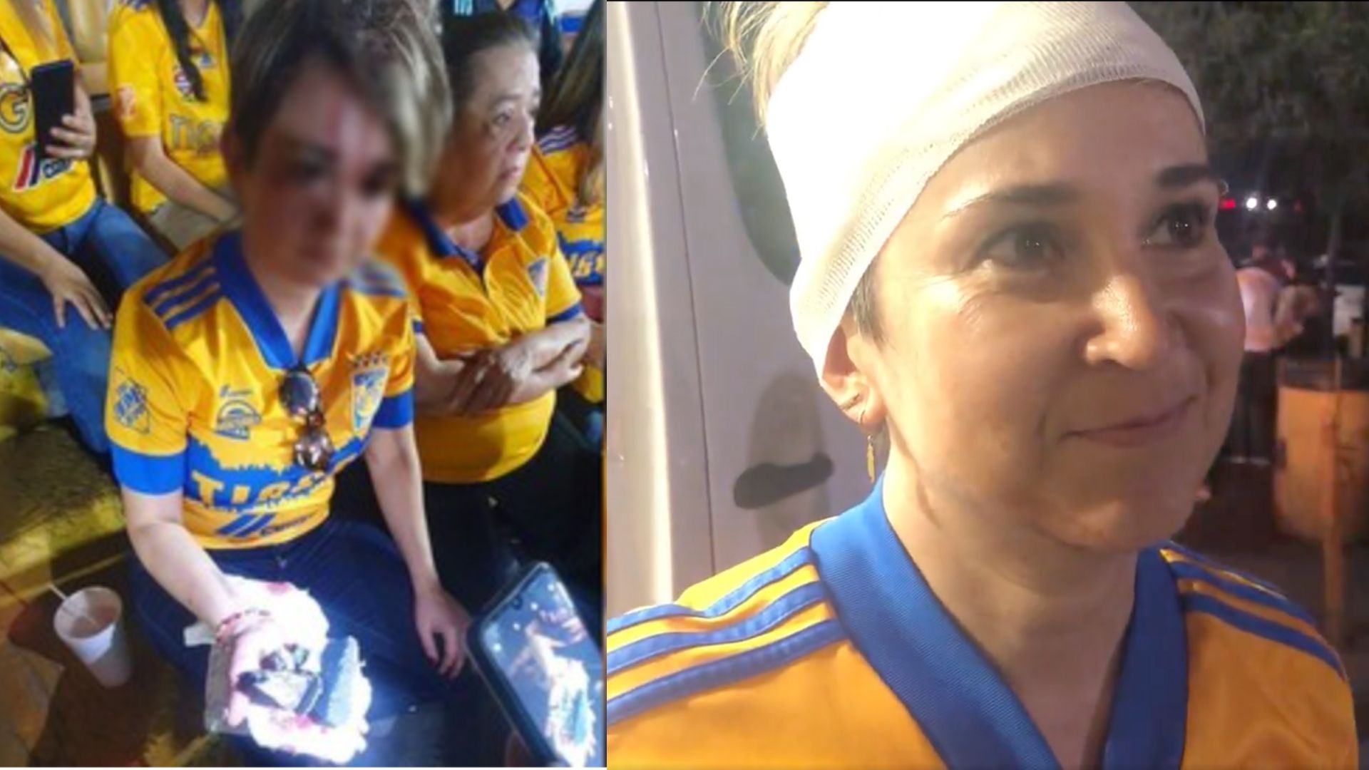 Aficionada de Tigres, lesionada al caerle un pedazo del estadio  Universitario – Publimetro México