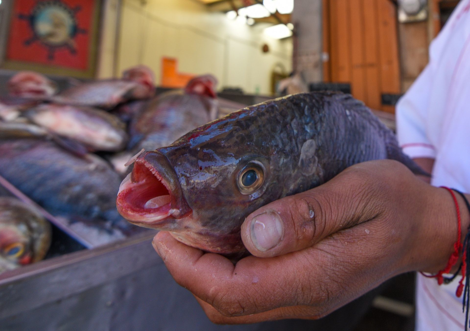 Amputan las cuatro extremidades a mujer tras comer un pescado