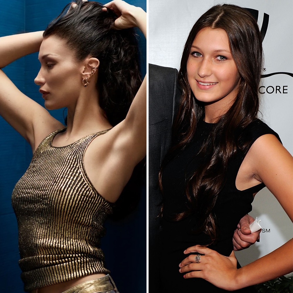 Bella Hadid conta sobre sua cirurgia plástica aos 14 anos – Nova Mulher