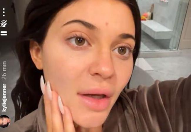 Kylie Jenner sin maquillaje deja ver su acné durante el embarazo