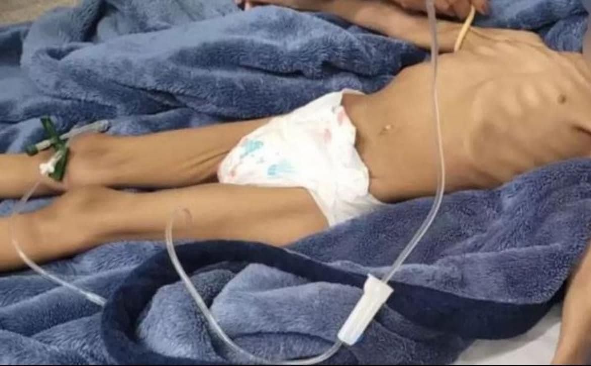 Homem que deixou filha de 3 anos sem comer por mais de 40 dias é solto; MP  recorre e pede prisão – Noticias R7