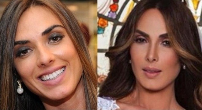 Nicole Bahls Antes E Depois.