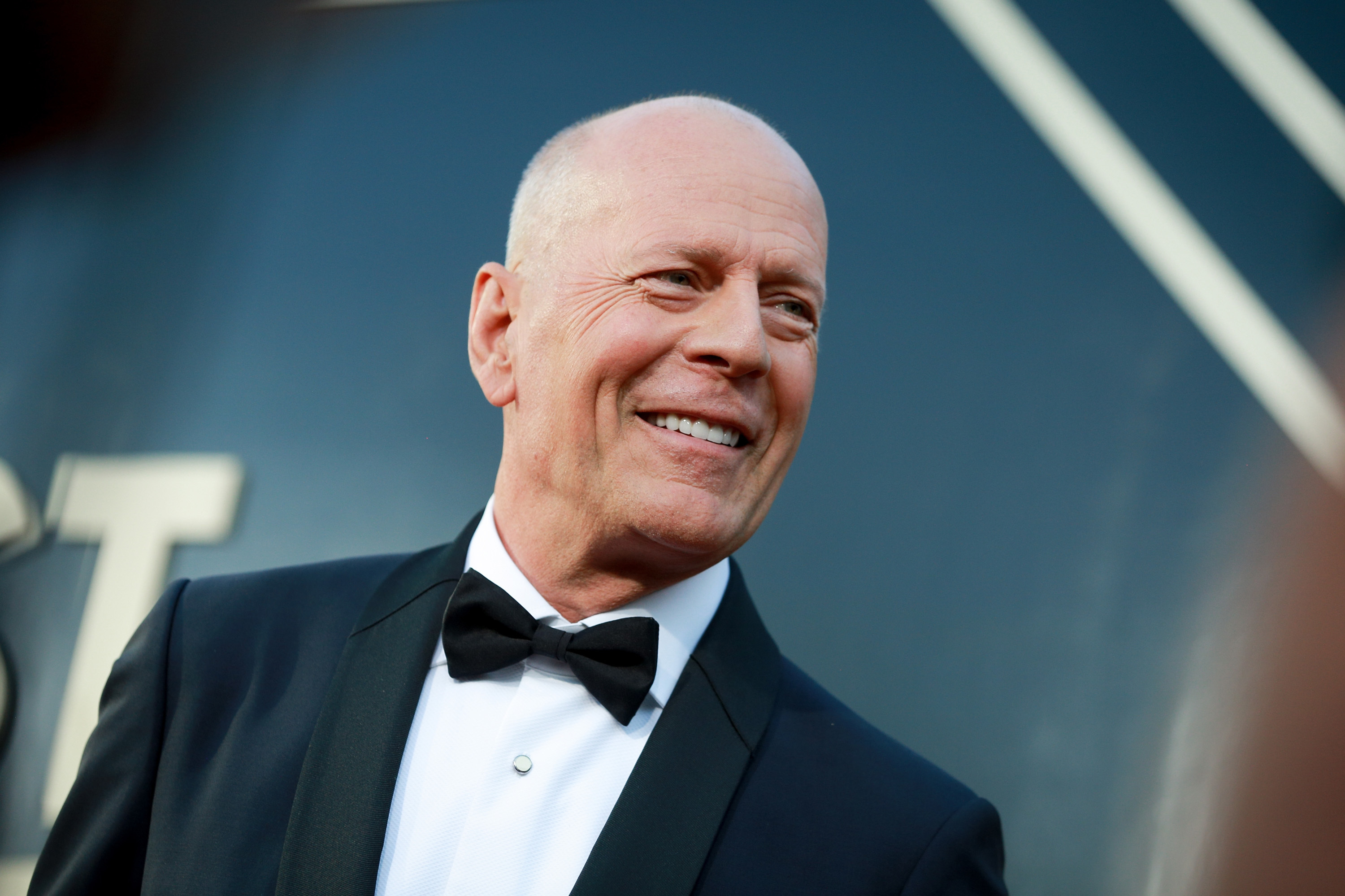 Bruce Willis' type of dementia one of several forms that can