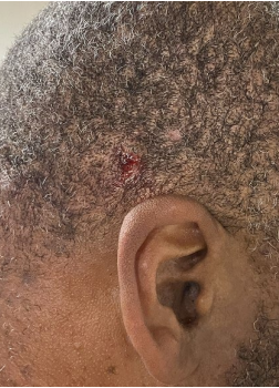 An unidentified Border Control officer shows a cut behind his ear, allegedly from a protester’s sign handle. More than 20 people are facing federal criminal charges from the recent protests.