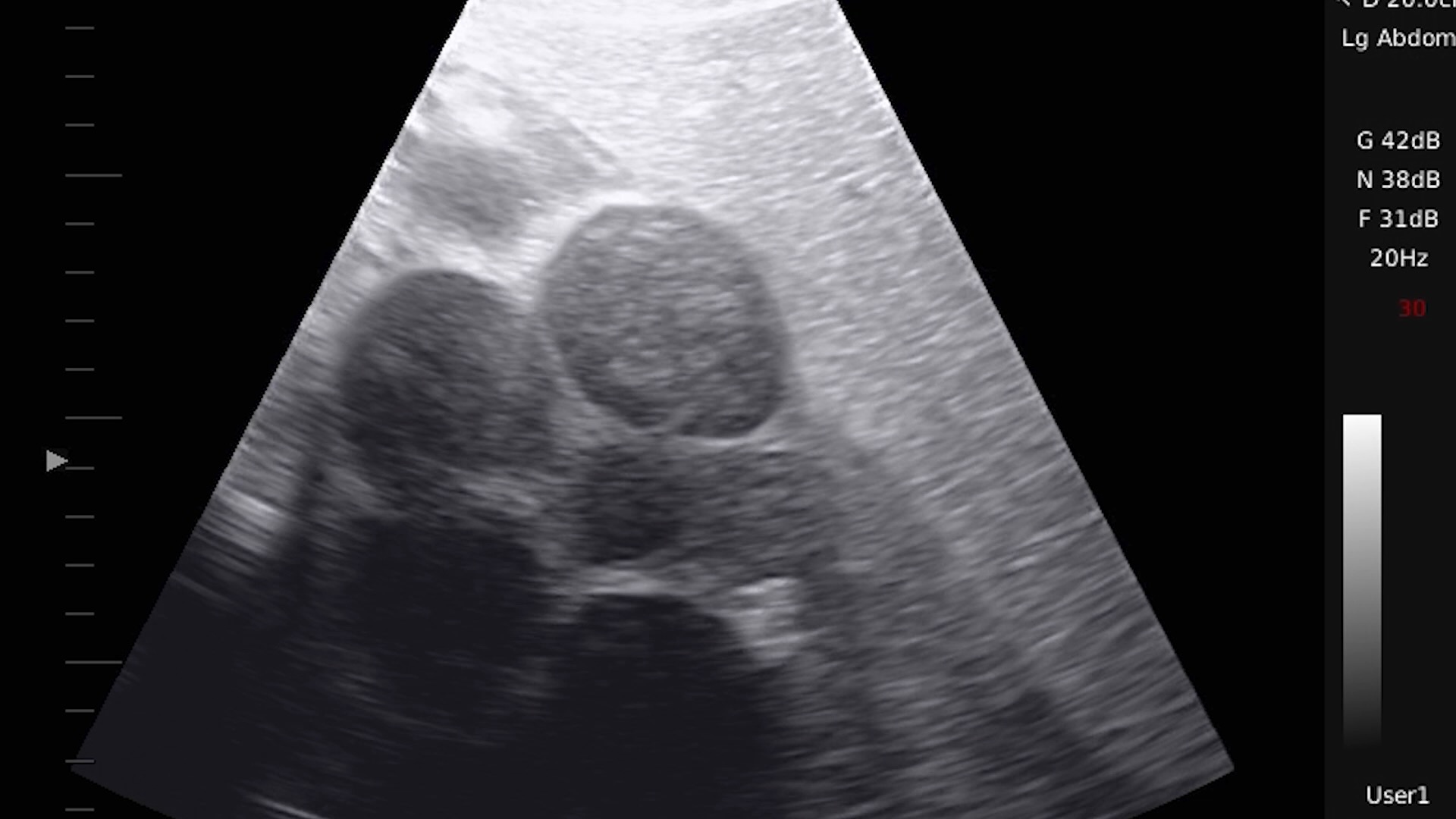 An image from an ultrasound of a large sevengill shark collected on July 23, 2025 shows a cluster of 2-inch eggs, which indicates that she is not pregnant now but can become pregnant at some point.