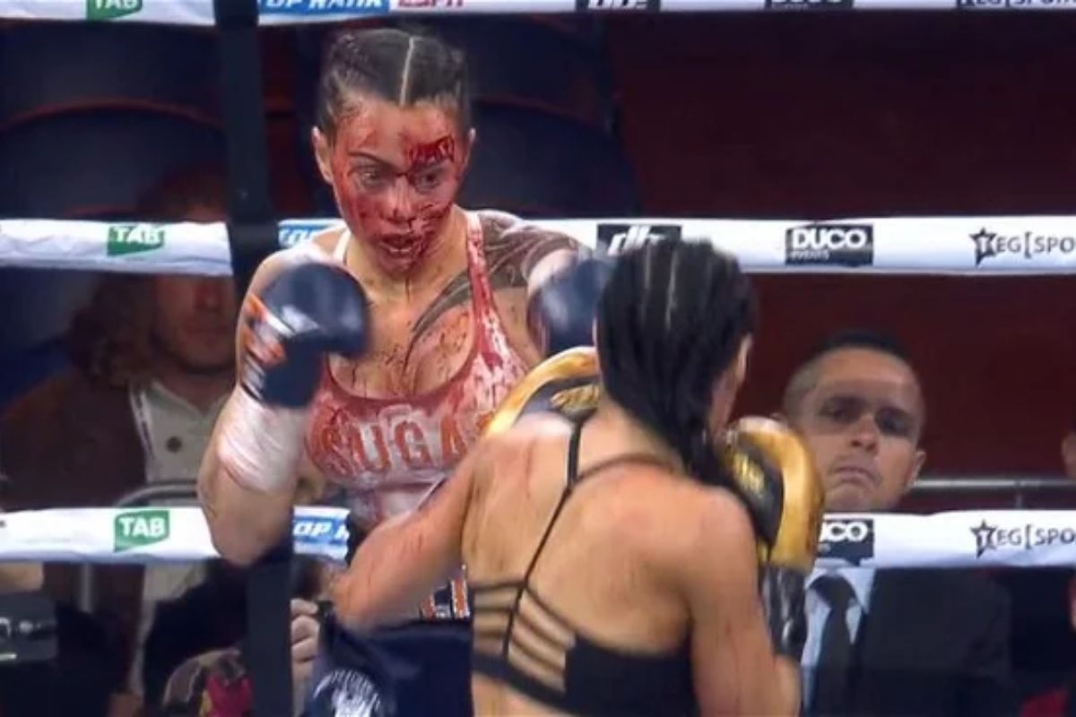 VIDEO | Así fue el severo corte que sufrió Cherneka Johnson ante Susie  Ramadan – En Cancha