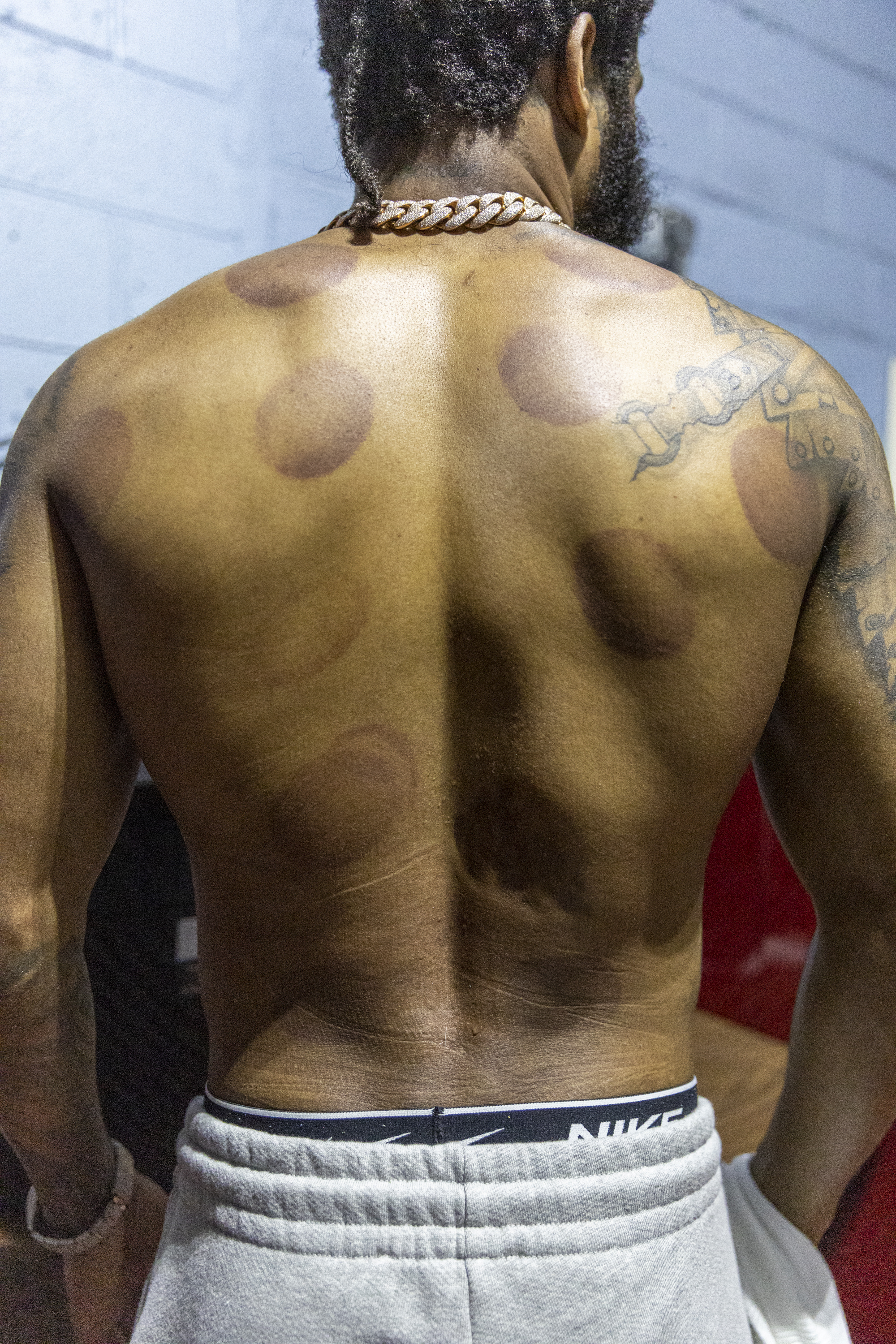 Philly boxer Stephen Fulton survived a tiger attack. Now hes ready to face The Monster in Japan