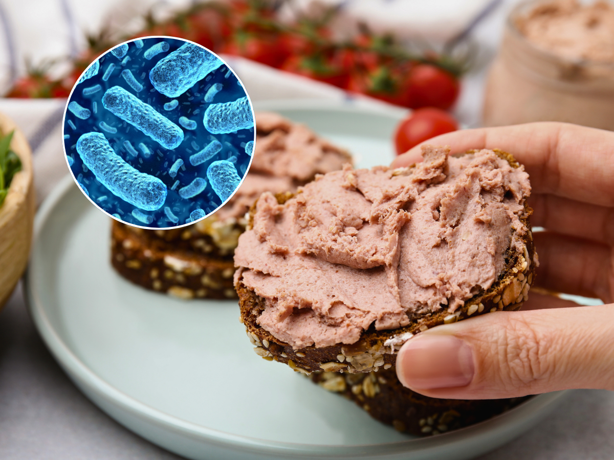Emiten alerta alimentaria tras detectar bacteria Listeria en arrollado huaso: revisa el lote y la marca