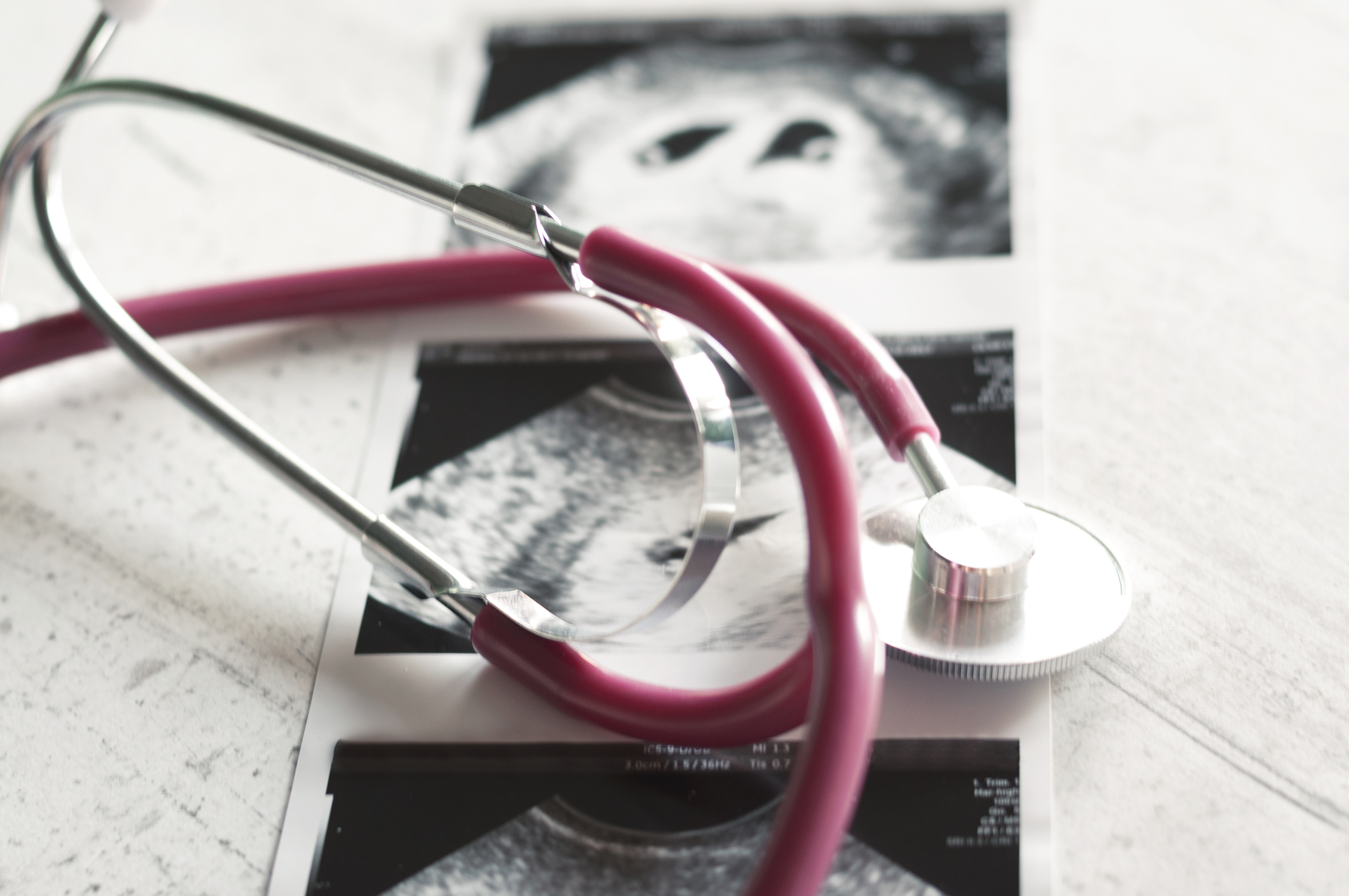 No hay un derecho fundamental al aborto en la jurisprudencia constitucional: Corte