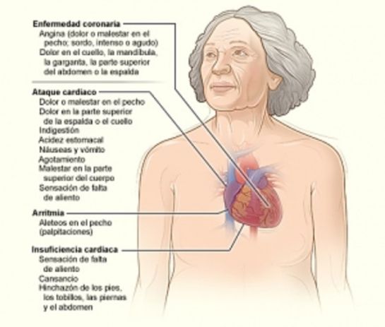 Qué es el síndrome del corazón roto?