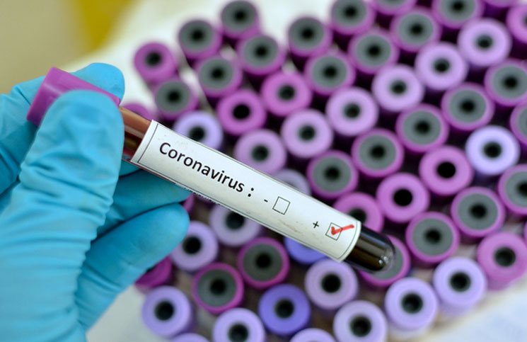 Coronavirus: 9 casos nuevos hospitalizados en la Ciudad de Buenos Aires