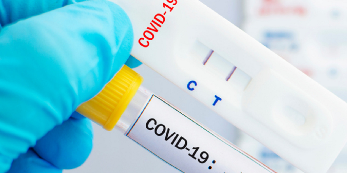 Ómicron redujo el tiempo de incubación: cómo interpretar el resultado de un test de coronavirus