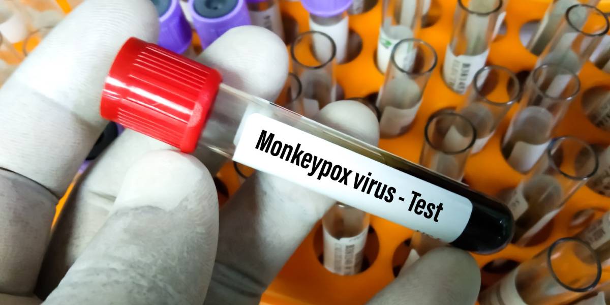 La OMS pidió redoblar los esfuerzos para mitigar la viruela del mono: “Aún se puede contener”