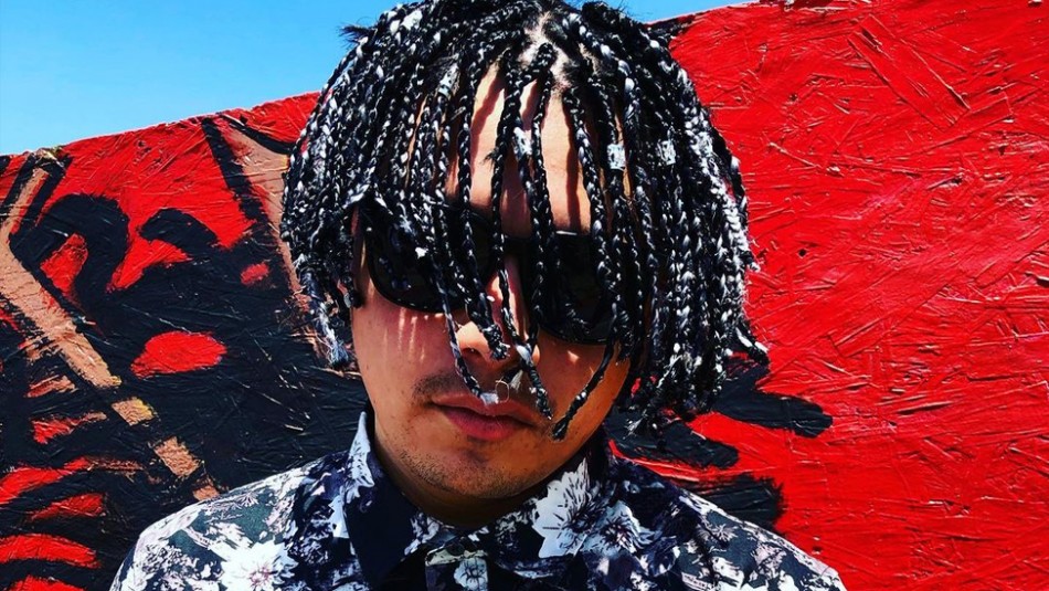 Un rapero implantó cadenas en lugar de pelo y se hizo viral en las redes: “Quería hacer algo diferente” | La 100