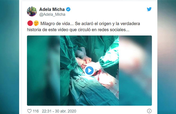 Video el increíble parto de un bebé dentro del saco amniótico