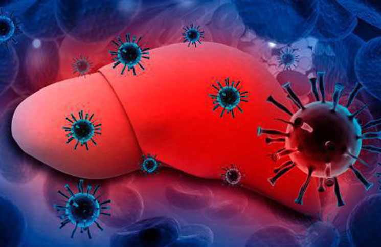 Hepatitis C | Qué es, cuáles son sus síntomas y cómo tratar la enfermedad |  La 100