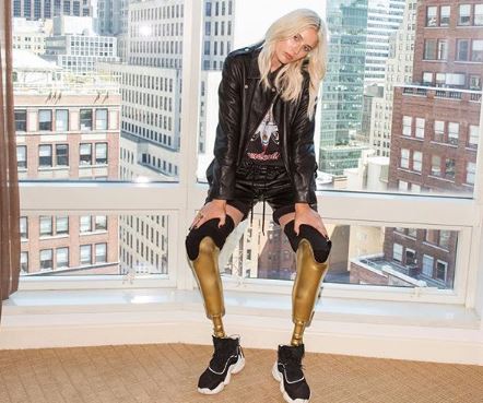 Así está hoy, Lauren Wasser, la modelo a la que le amputaron los piernas  por la infección de un tampón | Fashion Click