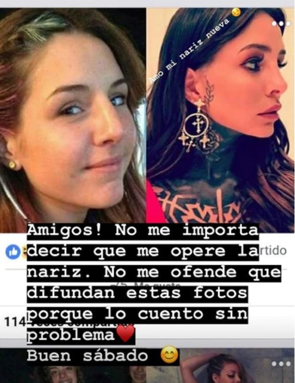 Tras Su Cambio De Look Cande Tinelli Confirmo La Cirugia Estetica Que Se Realizo Radio Mitre