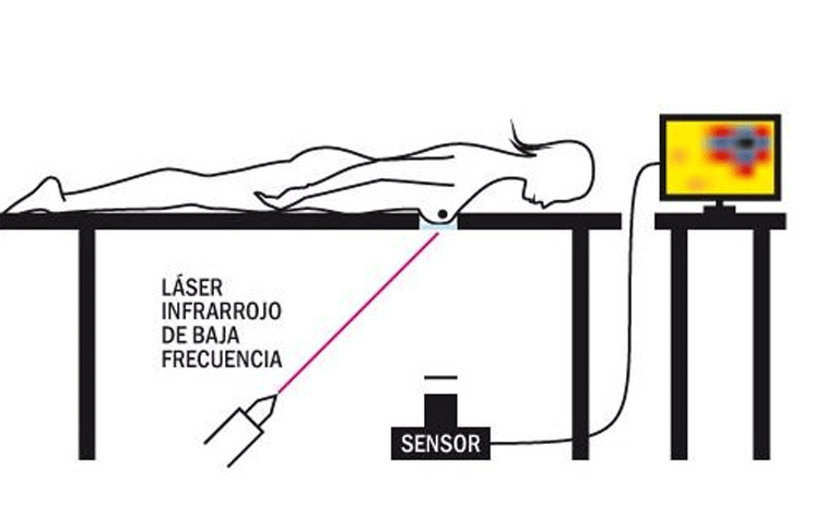 Así funciona el nuevo mamógrafo