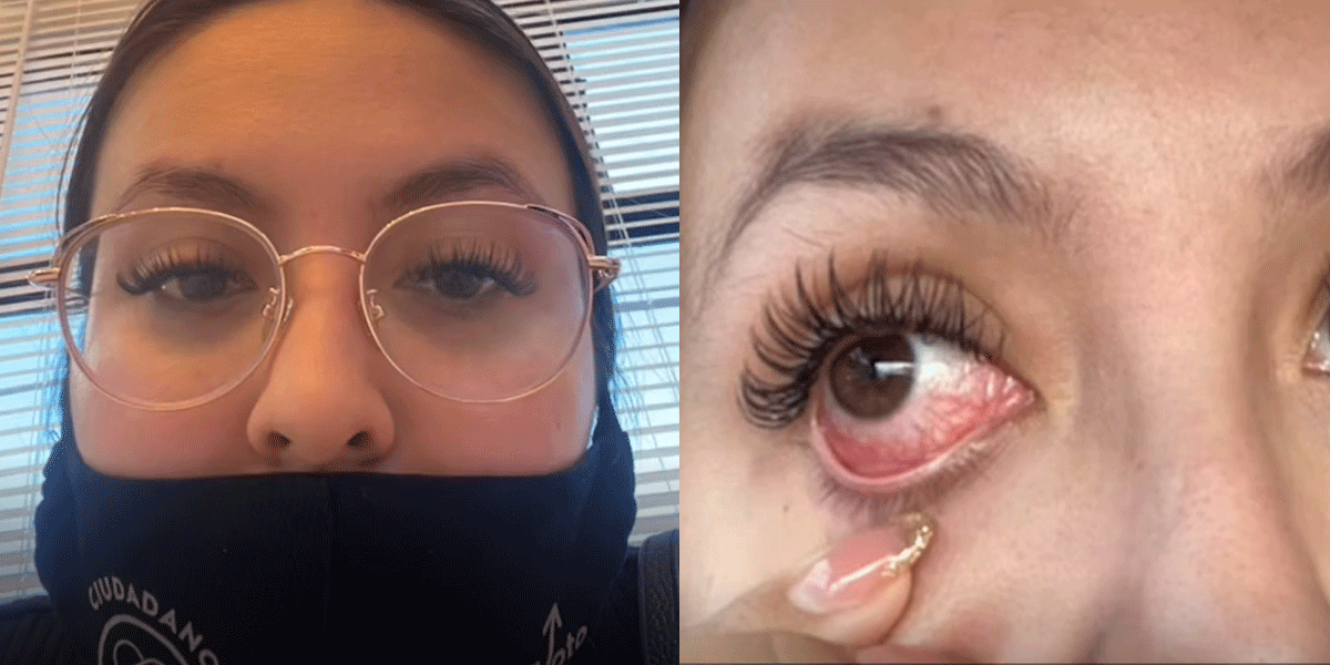 Una influencer se puso pestañas postizas y terminó con una infección en el ojo: “Dolían mucho”