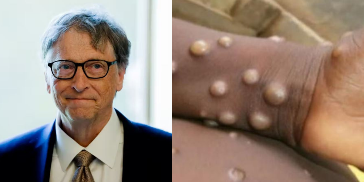 El pronóstico que Bill Gates hizo sobre la viruela: “podemos prevenir la próxima pandemia”