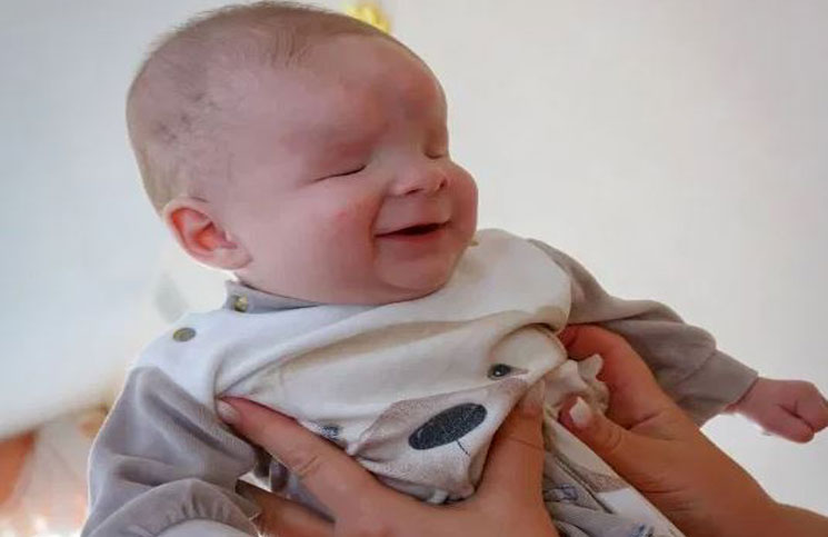 La Triste Historia Del Bebe Que Nacio Sin Ojos Y Fue Abandonado Por Su Mama La 100