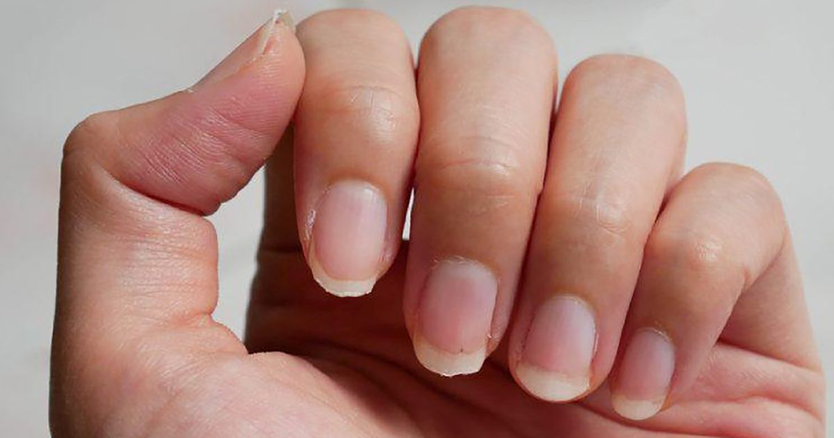 Las 6 señales que nunca debes ignorar en tus uñas: pueden ser mortales