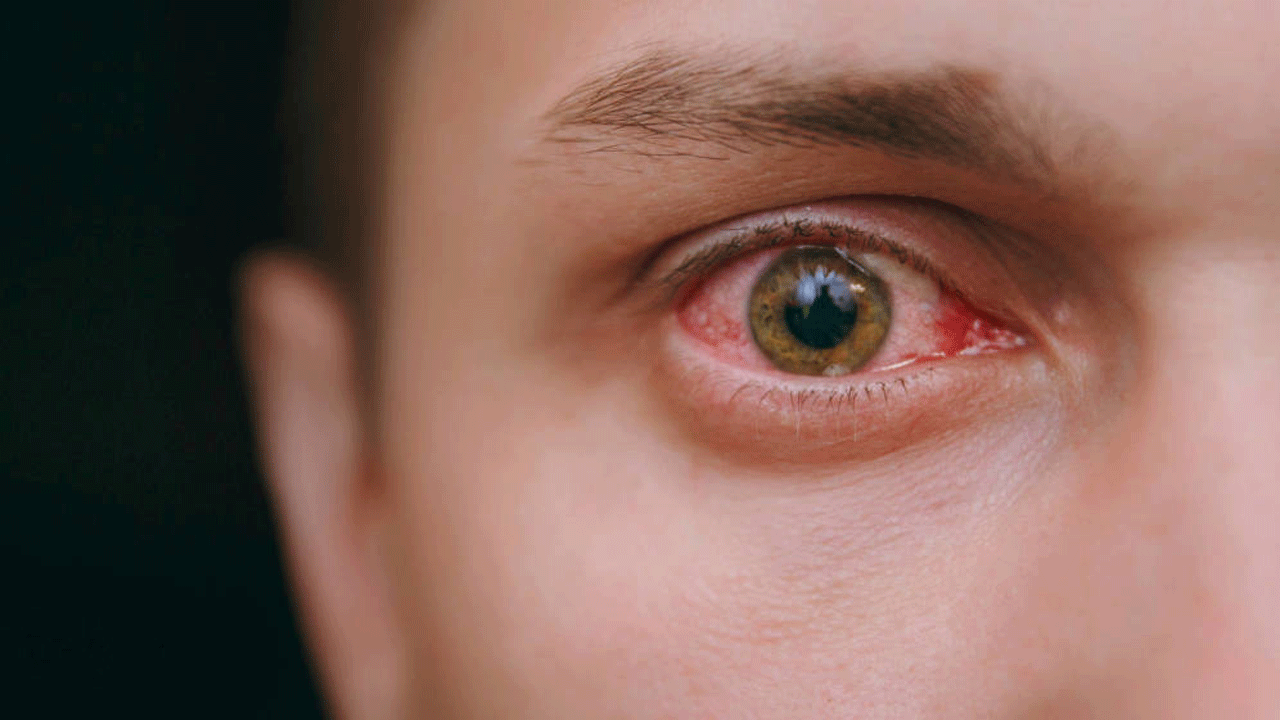 Los ojos revelan el estado de tu salud: claves para detectar y prevenir enfermedades