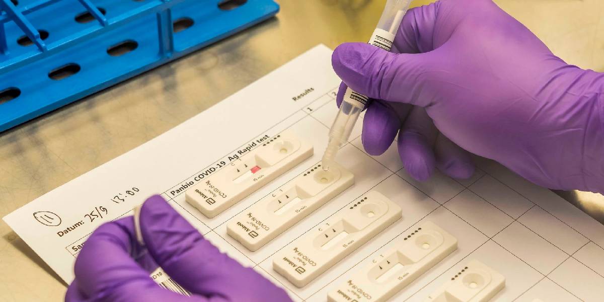 LA ANMAT prohibió un test de diagnóstico rápido de coronavirus por estar “falsificado”  