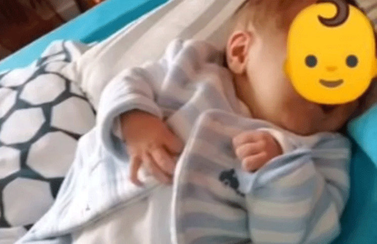 Video: el bebé sin rostro cumplió 5 meses pero no podrá vivir mucho más