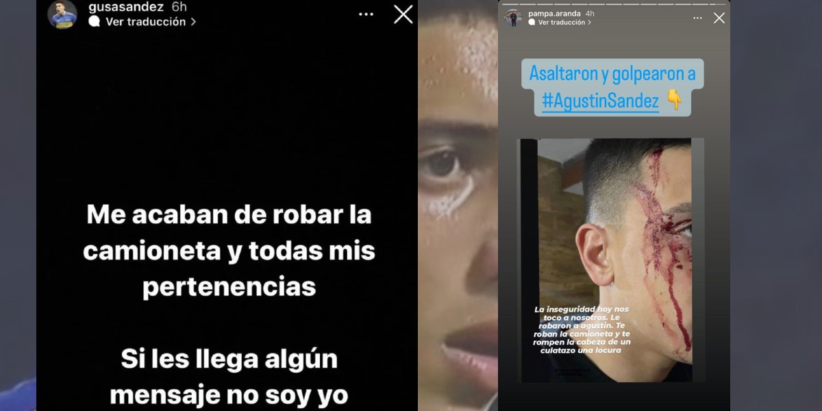 "Me acaban de robar la camioneta y todas mis pertenencias": Golpearon con un arma en la cabeza en un violento robo al jugador de Boca, Agustín Sandez