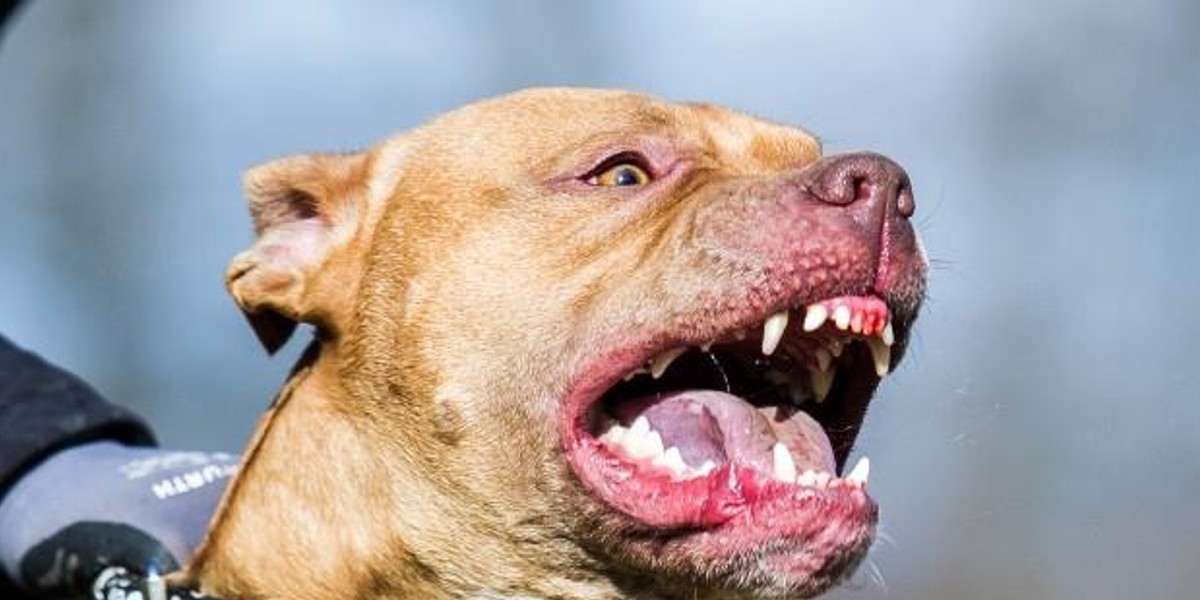 Feroz ataque de un pitbull: el perro mordió a su hijita y le dieron 50 puntos en la cara