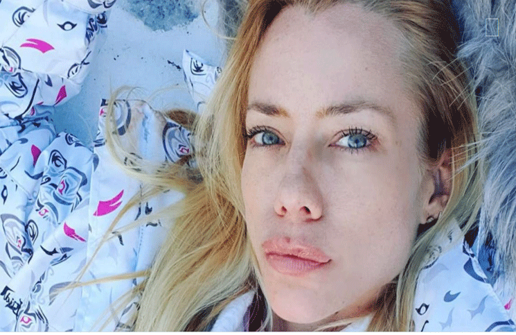 Nicole Neumann sufrió un ataque de abejas  y compartió su picadura en Instagram