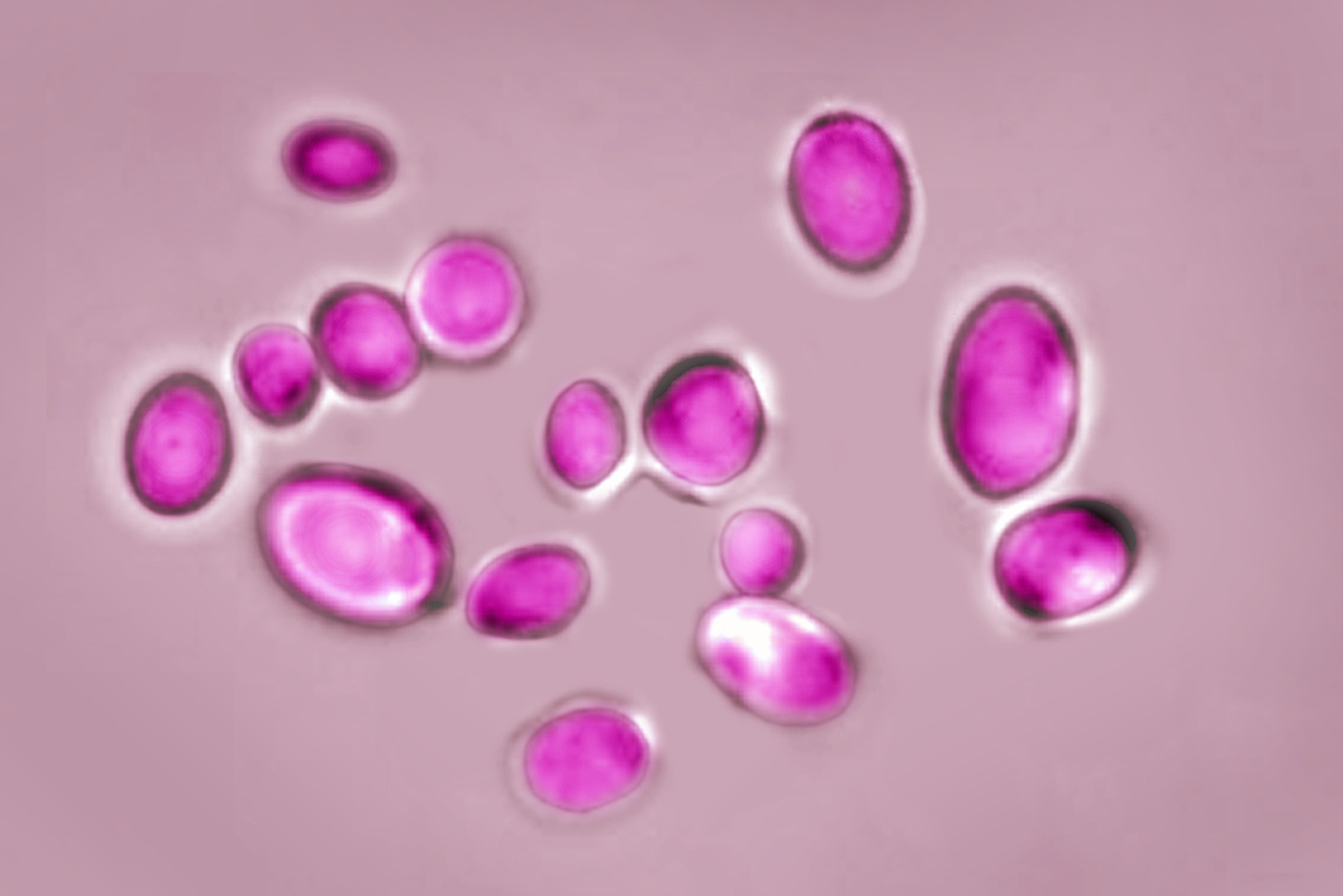 Candida auris is a yeast responsible for many infections. Resistant to most antifungal drugs, this fungus causes several deaths worldwide. Optical microscope view. (Photo by: BSIP/Education Images/Universal Images Group via Getty Images)