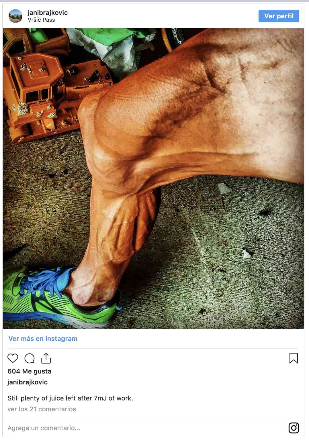 Las impresionantes imagenes de las piernas de un ciclista después de ...