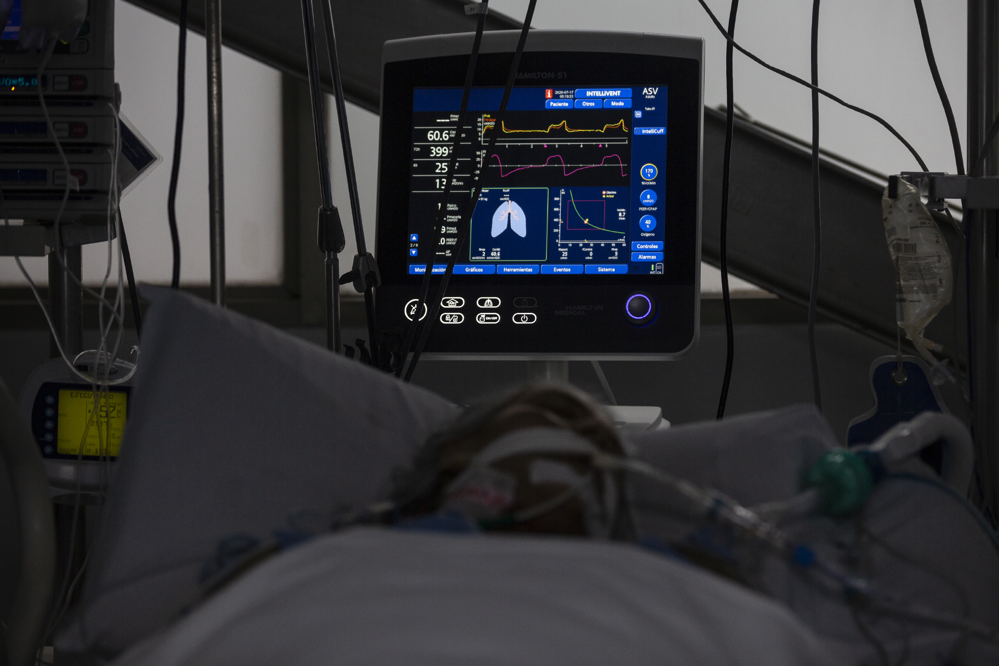 FUNDACION CARDIO INFANTIL BOGOTAUNIDAD DE CUIDADOS INTENSIVOS DE LA FUNDACION CARDIO INFANTILCOVID 19 CORONAVIRUS17 DE JULIO 2020FOTO: ESTEBAN VEGA LA-ROTTA