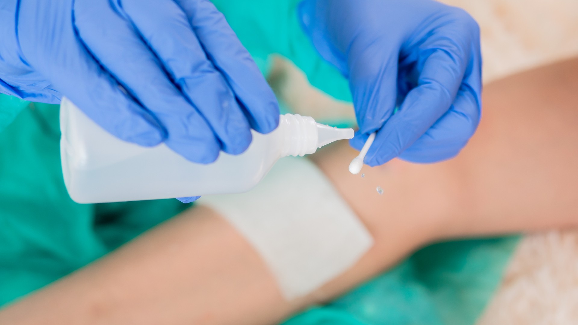 Alcohol vs. agua oxigenada, ¿cuál es la mejor opción?