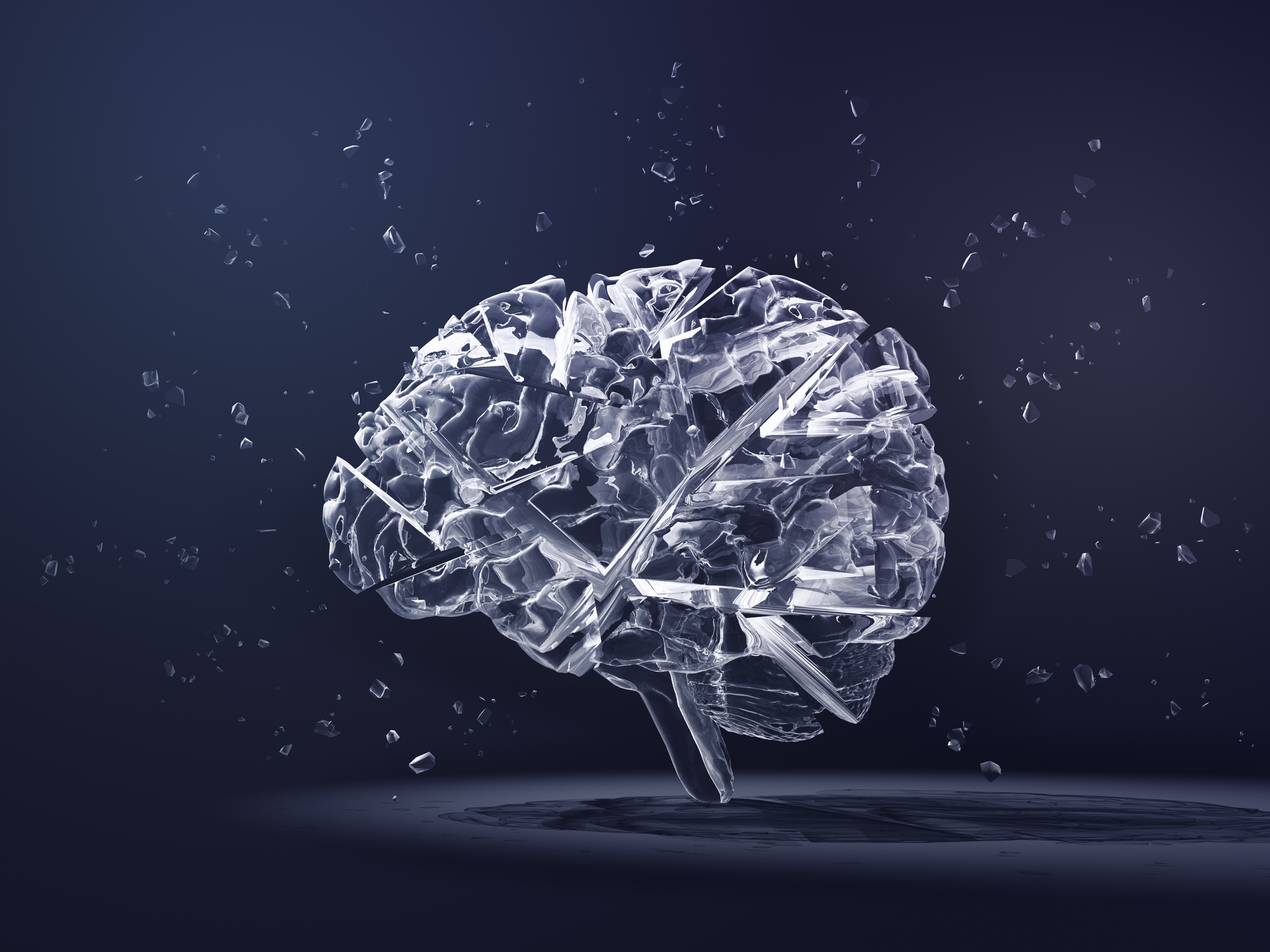 Foto de referencia de un cerebro