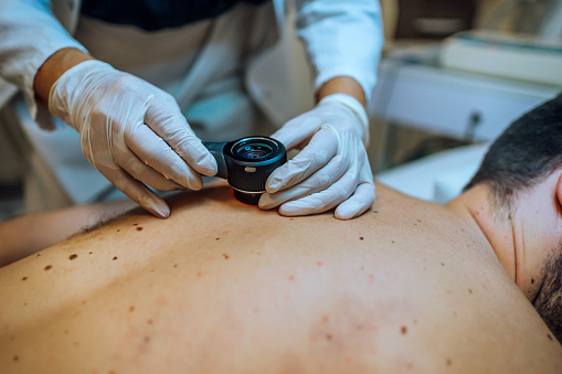 Las manchas rojizas en la piel son un síntoma de cáncer.