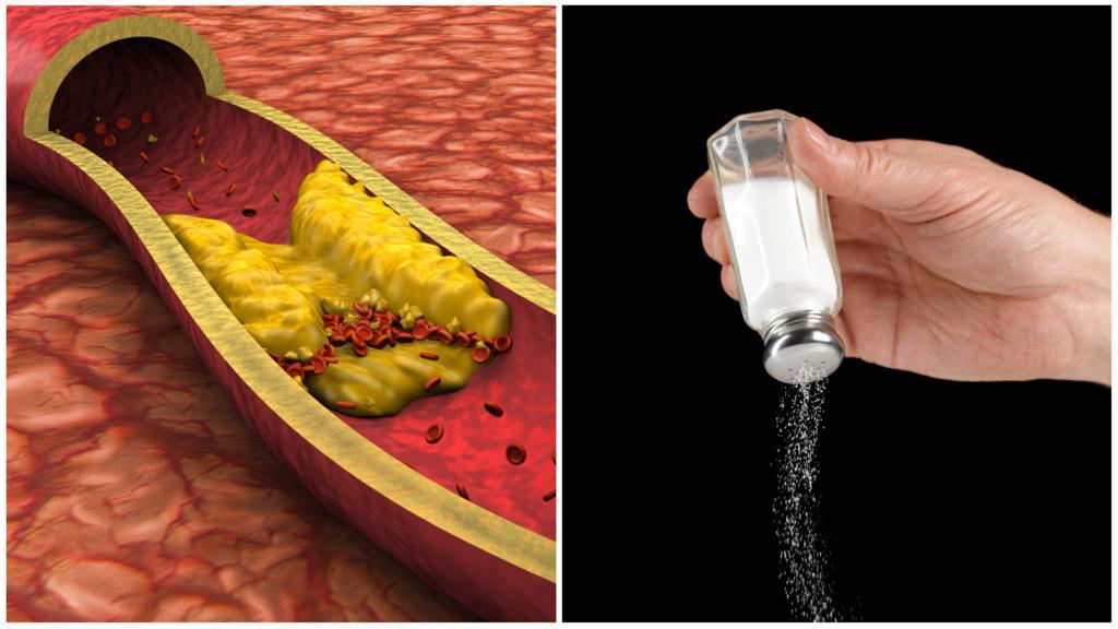 Colesterol y sal. Imagen de referencia.