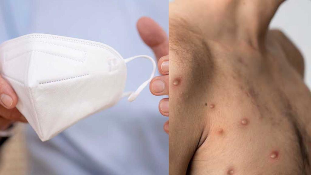 Viruela de Mono - Tapabocas