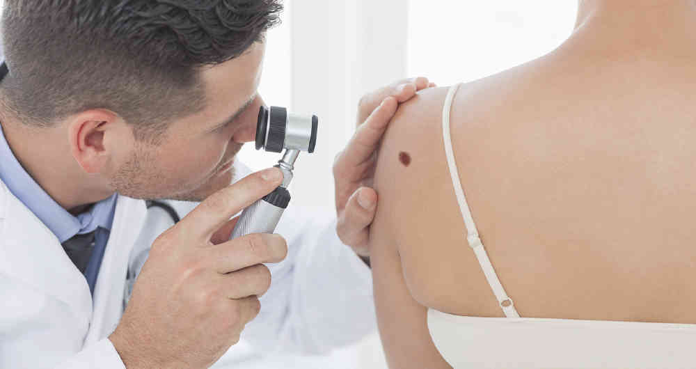 Artículo: Cáncer de piel: ¿Cómo estamos y qué nos falta por hacer?