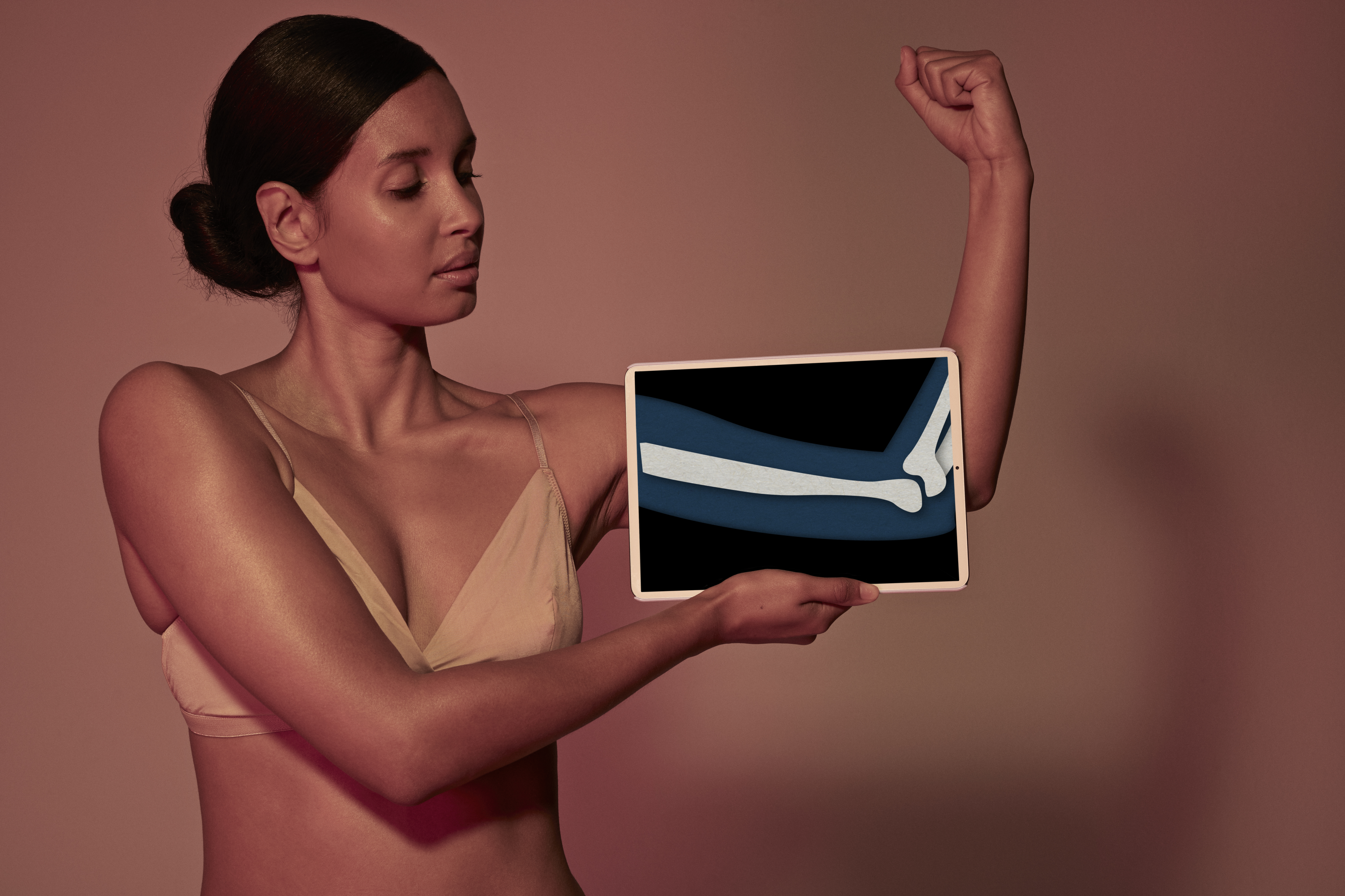 La vitamina D ayuda a mantener los huesos fuertes y saludables.