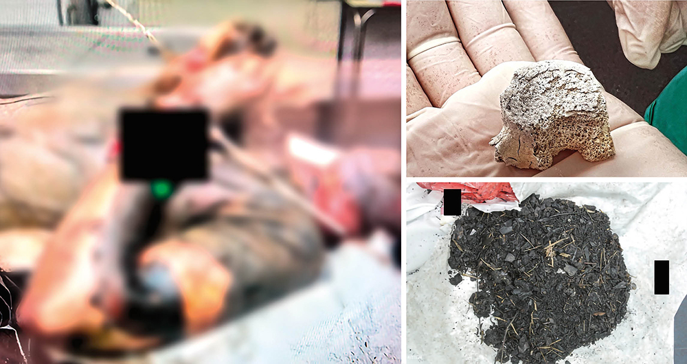 La doctora mostró a los colombianos el grado de deshumanización al que llegó Hamás en esta masacre. La forma en que encontraron los restos humanos, casi pulverizados e incinerados, muestra la intención de aniquilar a los israelíes. 